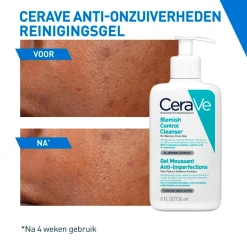 CeraVe Anti-Onzuiverheden Reinigingsgel New