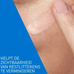 CeraVe Retinol Serum Tegen Post-Acne Vlekjes Best
