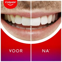 Colgate Max White Overnight Whitening Serum