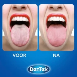 Dentek Orabrush 2-in-1 Tongreiniger New