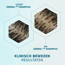 Head & Shoulders DermaXPro by Revitaliseert Antiroosshampoo Best