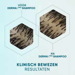 Head & Shoulders DermaXPro by Hydrateert Antiroosshampoo
