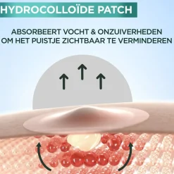 Garnier Skin Naturals Garnier PureActive Pimple Patches Sale