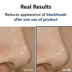 ISNTREE Hyper Acid4 AHA BHA PHA LHA 30 Serum Hot