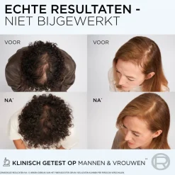 Elvive L'Oréal Paris Fiber Booster Anti-Haaruitval Shampoo Hot