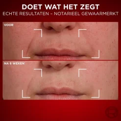 L'Oreal Paris L'Oréal Paris Revitalift Laser Anti-Rimpel Dagcrème Online