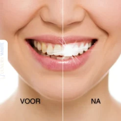 Luxury White Whitening Pen Sale