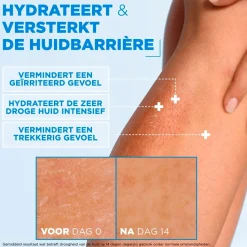 Mixa Ceramide Protect Hydraterende Crème Discount