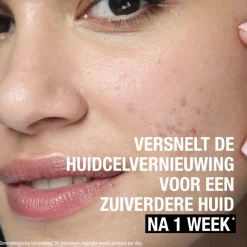 Neutrogena Anti-Puistjes+ Wasgel Outlet