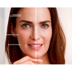 Nivea Skincare NIVEA Cellular Luminous630 Anti-Spot SPF50 Dagcrème Outlet