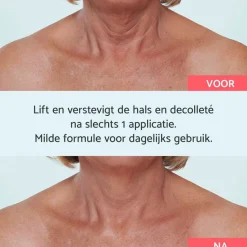 Remescar Hals & Décolleté Crème