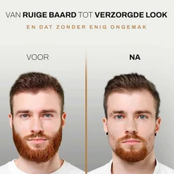 Sansbeauté 6-in-1 Baardtrimmer Met Opbergstandaard - Bodygroomer - Haartrimmer Sale