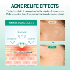 SOMEBYMI SOME BY MI Clear Spot Patch Sale