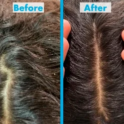 Umberto Giannini Scalp Scrub Outlet